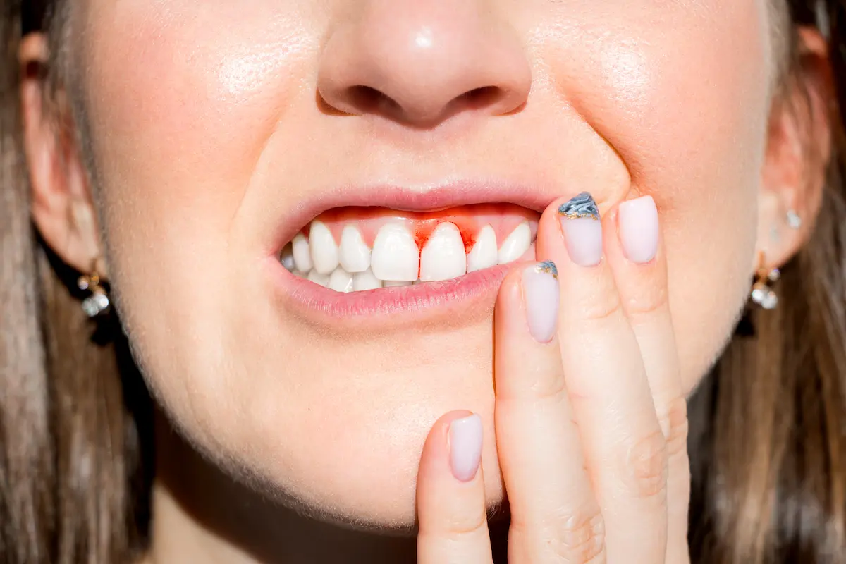 12 Symptoms of Vitamin C Deficiency You Should Know